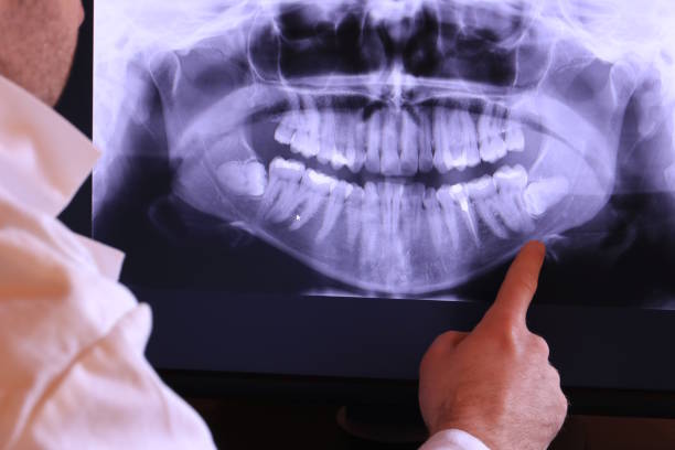 Best Tooth Infection Emergency Dentist  in Solomon, KS
