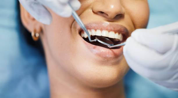 Best Root Canal Emergency Dentist  in Solomon, KS